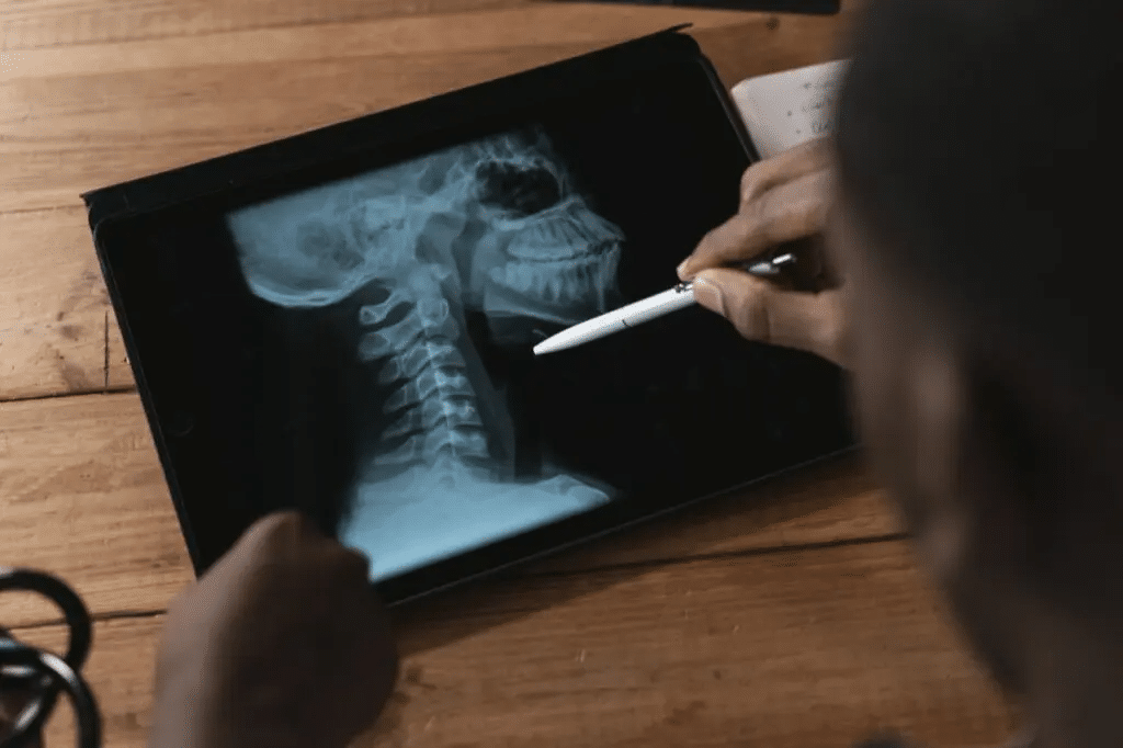 Revolutionizing Healthcare: The Rise of X-Ray Apps